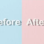 BEFORE&AFTER